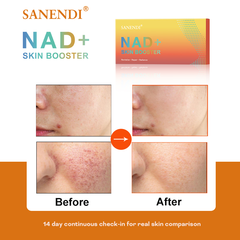 Sanendi NAD+ Korea Skincare Pr – Korean Skincare Routine Bewertung und Preis