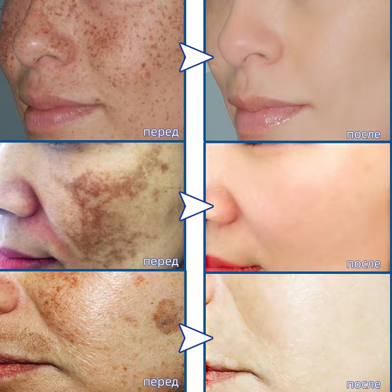 Powerful Spot-removing Whiteni – Korean Skincare Routine Bewertung und Preis