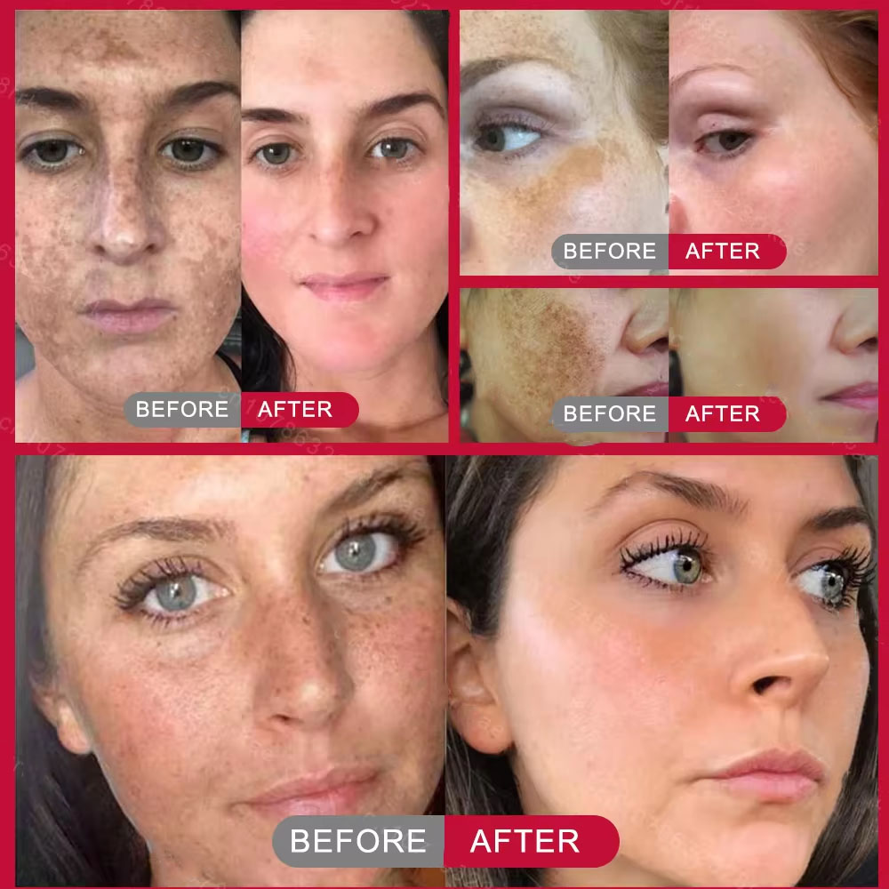 Powerful Spot-removing Whiteni – Korean Skincare Routine Bewertung und Preis